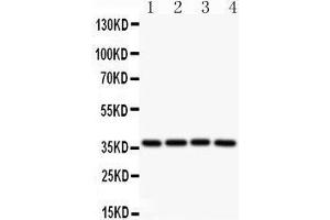 Observed bind size: 37KD (MCL-1 anticorps  (AA 1-350))