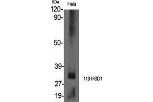 Western Blot (WB) analysis of specific cells using 11beta-HSD1 Polyclonal Antibody.