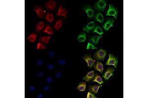 ABIN6258272 and ABIN6274405 staining Hela by IF/ICC.