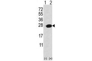 Image no. 1 for anti-Adenine Phosphoribosyltransferase (APRT) (C-Term) antibody (ABIN452752) (APRT anticorps  (C-Term))