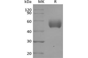 Western Blotting (WB) image for Signal-Regulatory Protein alpha (SIRPA) (Active) protein (His tag) (ABIN7319795)