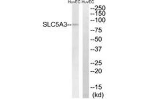 Western blot analysis of extracts from HuvEc cells, using SLC5A3 Antibody. (SLC5A3 anticorps  (AA 221-270))