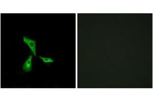 Immunofluorescence analysis of HeLa cells, using GPR101 Antibody. (GPR101 anticorps  (AA 451-500))