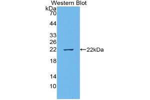 Western blot analysis of recombinant Human EREG. (Epiregulin anticorps  (AA 1-162))