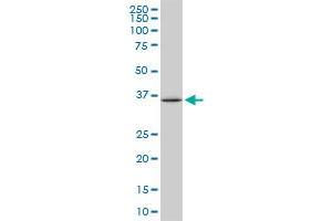 SPP1 monoclonal antibody (M05), clone 1F5.