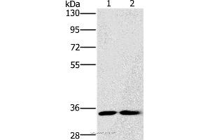 Western blot analysis of A172 and Raji cell, using FAIM2 Polyclonal Antibody at dilution of 1:500 (FAIM2 anticorps)
