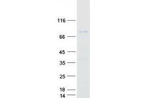 Validation with Western Blot