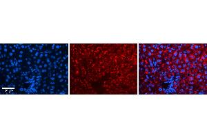 Rabbit Anti-IRF1 Antibody Catalog Number: ARP38129_P050 Formalin Fixed Paraffin Embedded Tissue: Human Liver Tissue Observed Staining: Cytoplasm in hepatocytes Primary Antibody Concentration: N/A Other Working Concentrations: 1:600 Secondary Antibody: Donkey anti-Rabbit-Cy3 Secondary Antibody Concentration: 1:200 Magnification: 20X Exposure Time: 0.