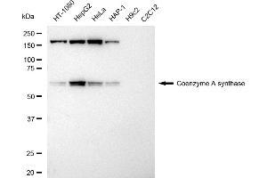 Western blotting analysis using Coenzyme A synthase antibody (ABIN7798104). (Recombinant COASY anticorps)