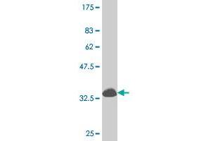 Western Blot detection against Immunogen (34. (DLX1 anticorps  (AA 181-254))