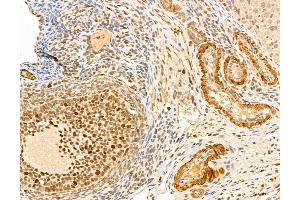 ABIN7094349 and ABIN7098396 at 1/100 staining Rat ovary tissue by IHC-P.