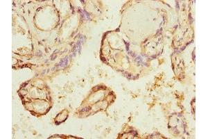 Immunohistochemistry of paraffin-embedded human placenta tissue using ABIN7147657 at dilution of 1:100 (GCM1 anticorps  (AA 207-436))