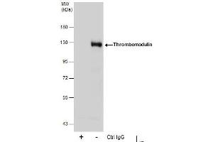 IP Image Immunoprecipitation of Thrombomodulin protein from THP-1 whole cell extracts using 5 μg of Thrombomodulin antibody [C3], C-term, Western blot analysis was performed using Thrombomodulin antibody [C3], C-term, EasyBlot anti-Rabbit IgG  was used as a secondary reagent. (Thrombomodulin anticorps  (C-Term))