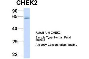Host:  Rabbit  Target Name:  CHEK2  Sample Type:  Human Fetal Muscle  Antibody Dilution:  1. (CHEK2 anticorps  (N-Term))