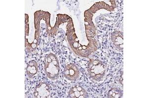 Immunohistochemical staining of human rectum with WDR69 polyclonal antibody  shows moderate cytoplasmic and membranous positivity in glandular cells. (WDR69 anticorps)