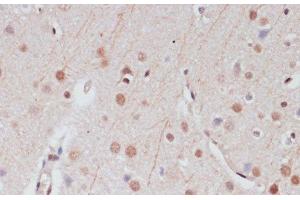 Immunohistochemistry of paraffin-embedded Rat brain using CREB1 Polyclonal Antibody at dilution of 1:100 (40x lens). (CREB1 anticorps)