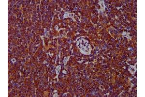 IHC image of ABIN7150062 diluted at 1:400 and staining in paraffin-embedded human lymph node tissue performed on a Leica BondTM system.