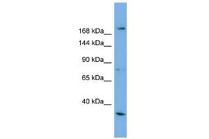 WB Suggested Anti-ALS2 Antibody Titration: 0. (ALS2 anticorps  (Middle Region))