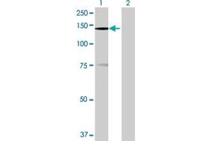 Western Blot analysis of MPHOSPH9 expression in transfected 293T cell line by MPHOSPH9 MaxPab polyclonal antibody. (MPHOSPH9 anticorps  (AA 1-1031))