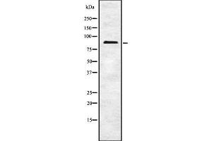 Western blot analysis FAKD5 using COLO205 whole cell lysates