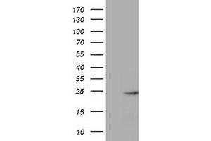Western Blotting (WB) image for anti-MOB Kinase Activator 1B (MOB1B) antibody (ABIN1499531) (MOBKL1A anticorps)