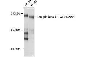 Western blot analysis of extracts of various cell lines, using Integrin beta 4 (ITGB4/CD104) (ITGB4/CD104) Rabbit mAb (ABIN7267931) at 1:1000 dilution. (Integrin beta 4 anticorps)