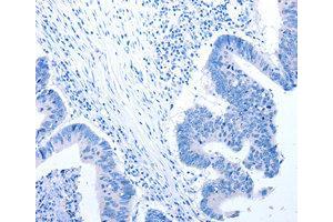 Immunohistochemistry (IHC) image for anti-Ciliary Neurotrophic Factor Receptor (CNTFR) antibody (ABIN1871941) (CNTF Receptor alpha anticorps)