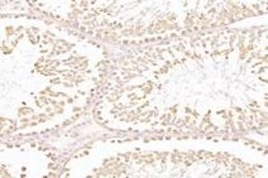 Immunohistochemistry analysis of paraffin-embedded mouse testis using,NXF2 (ABIN7074901) at dilution of 1: 3000 (NXF2 anticorps)