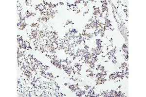 IHC analysis of DCC using anti-DCC antibody (ABIN7602566).