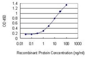 Detection limit for recombinant GST tagged SOD1 is 0.