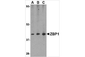 Western blot analysis of ZBP1 in mouse small intestine tissue lysate with ZBP1 antibody at (A) 0. (ZBP1 anticorps  (C-Term))