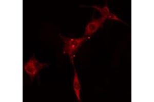 ABIN6274170 staining 293 cells by IF/ICC. (PRKAR2A anticorps  (N-Term))
