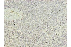 Immunohistochemistry of paraffin-embedded human spleen tissue using ABIN7174417 at dilution of 1:100 (UBASH3B anticorps  (AA 1-300))