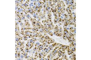 Immunohistochemistry of paraffin-embedded Rat liver using TrkA antibody (ABIN7268895) at dilution of 1:100 (40x lens). (TRKA anticorps  (C-Term))