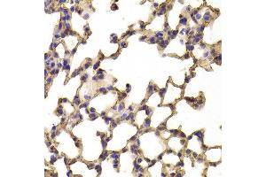 Immunohistochemistry of paraffin-embedded Mouse lung using TPP2 antibody at dilution of 1:100 (x400 lens).