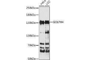 Western blot analysis of extracts of various cell lines, using GOLPH4 antibody (ABIN7267489) at 1:1000 dilution.