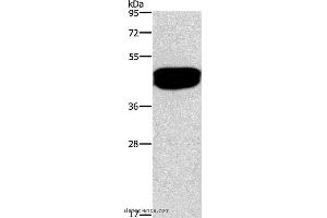 Western blot analysis of Human prostate tissue, using SDCCAG3 Polyclonal Antibody at dilution of 1:500 (SDCCAG3 anticorps)