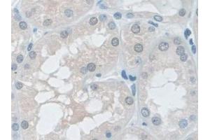 Detection of VCP in Human Kidney Tissue using Polyclonal Antibody to Valosin Containing Protein (VCP)
