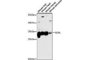 Western blot analysis of extracts of various cell lines, using SDSL antibody (ABIN7270209) at 1:1000 dilution. (SDSL anticorps  (AA 1-137))
