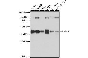 Western blot analysis of extracts of various cell lines, using SMN2 antibody. (SMN2 anticorps  (AA 1-197))