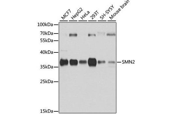SMN2 anticorps  (AA 1-197)