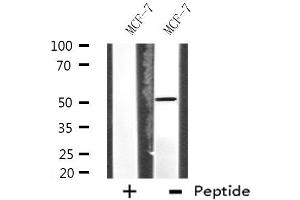 Western blot analysis of extracts from MCF-7 cells, using HUCE1 antibody. (RRP8 anticorps  (Internal Region))