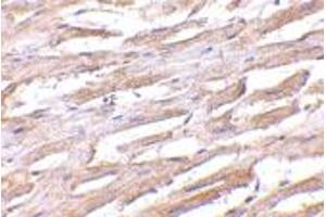 Immunohistochemistry of UNC93B1 in human heart with UNC93B1 polyclonal antibody  at 2.