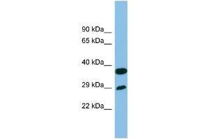 WB Suggested Anti-RTP4 Antibody Titration: 0. (RTP4 anticorps  (Middle Region))