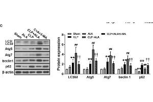 Effects of ALA on cardiac function, inflammation and autophagy in CLP-induced septic rats. (ATG5 anticorps  (AA 1-275))