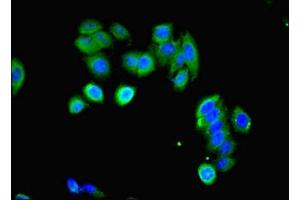 Immunofluorescent analysis of HepG2 cells using ABIN7158591 at dilution of 1:100 and Alexa Fluor 488-congugated AffiniPure Goat Anti-Rabbit IgG(H+L)