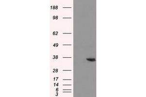 Western Blotting (WB) image for anti-Aldo-Keto Reductase Family 1, Member A1 (Aldehyde Reductase) (AKR1A1) antibody (ABIN1496539) (AKR1A1 anticorps)