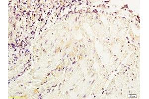 Formalin-fixed and paraffin embedded dog bladder tissue labeled with Anti-NSE/ENO2/γ Enolase Polyclonal Antibody, Unconjugated  at 1:800, followed by conjugation to the secondary antibody and DAB staining (ENO2/NSE anticorps  (AA 201-300))