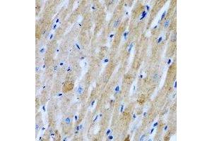 Immunohistochemical analysis of GlyRS staining in rat heart formalin fixed paraffin embedded tissue section. (GlyRS anticorps)