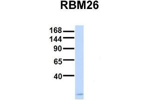 Host:  Rabbit  Target Name:  RBM26  Sample Type:  Human Fetal Brain  Antibody Dilution:  1. (RBM26 anticorps  (Middle Region))